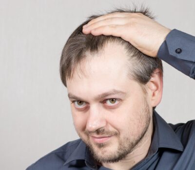 Big forehead check | haircut for big foreheads | TikTok